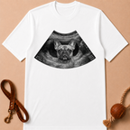 ULTRASOUND FRENCH BULLDOG T-SHIRT